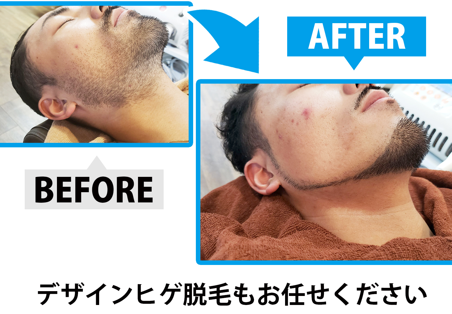 BEFORE_AFTER
